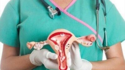 Waspada Kanker Serviks! Perempuan Diimbau Manfaatkan IVA Test Gratis di Puskesmas